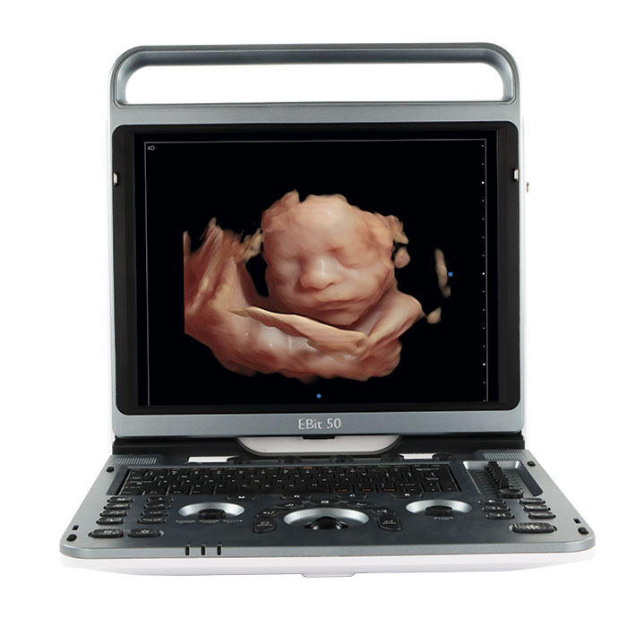 SISTEMA ULTRASÓNICO DOPPLER COLOR PORTÁTIL ZGN-P30